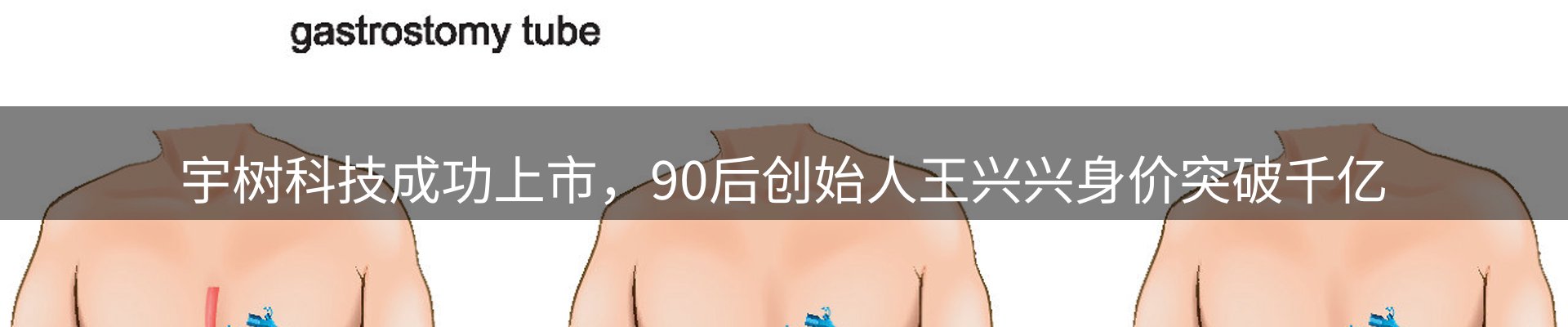 焦点探析